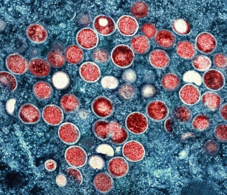House Republicans accuse NIH of ‘stonewalling’ on ‘supercharged monkeypox experiment’