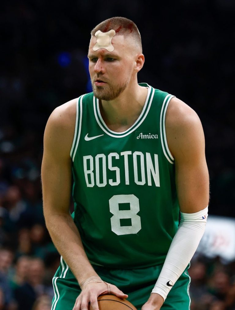 Bloodied Kristaps Porzingis exits Game 2 vs. Magic with head gash